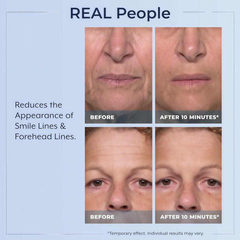 Rapid Reduction Serum