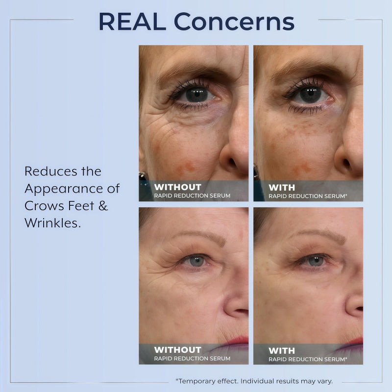 Rapid Reduction Serum