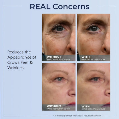 Rapid Reduction Serum