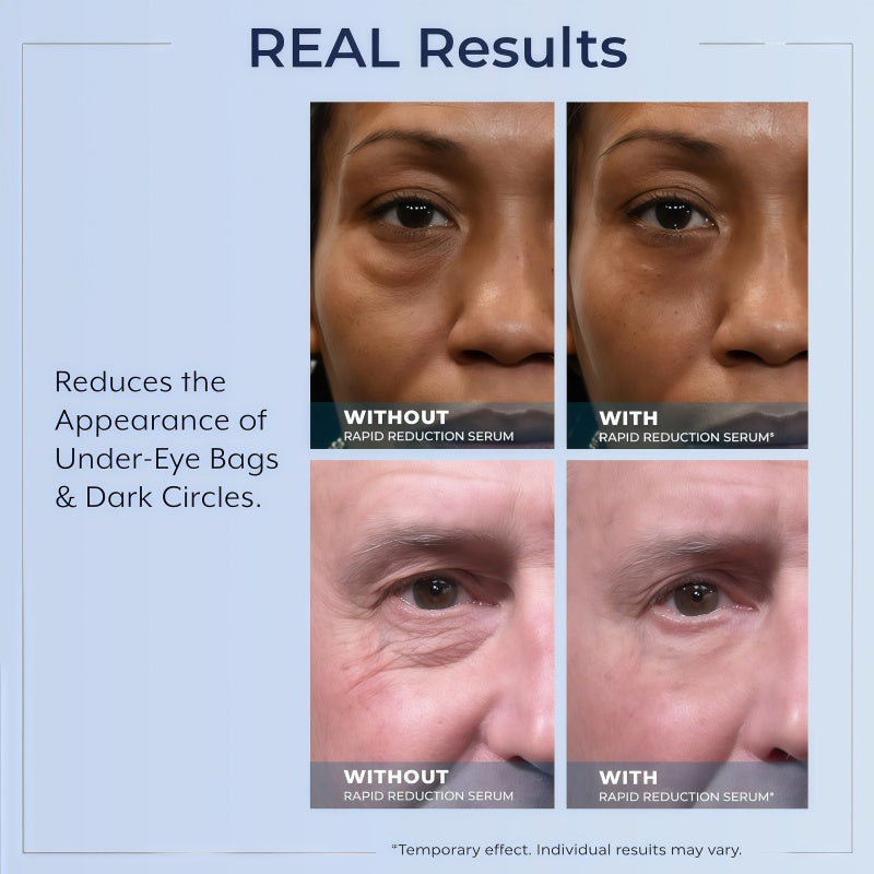 Rapid Reduction Serum